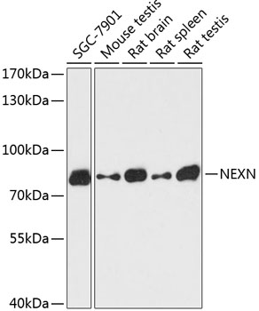 Anti-Nexilin / F-actin-binding protein Antibody