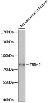Anti-TRIM2 Antibody