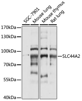 Anti-SLC44A2 Antibody