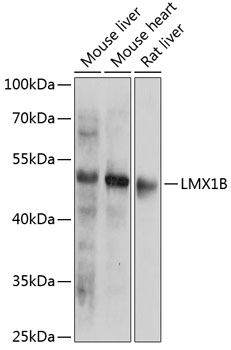 Anti-LMX1b Antibody