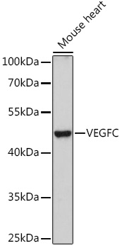 Anti-VEGFC Antibody