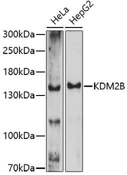Anti-KDM2B Antibody