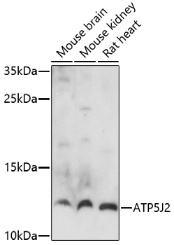 Anti-ATP5J2 Antibody