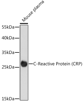 Anti-C Reactive Protein Antibody