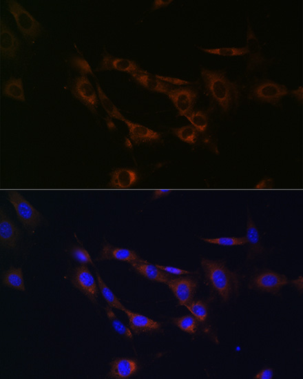 Anti-ABCA1 Antibody