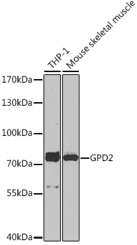 Anti-GPD2 Antibody