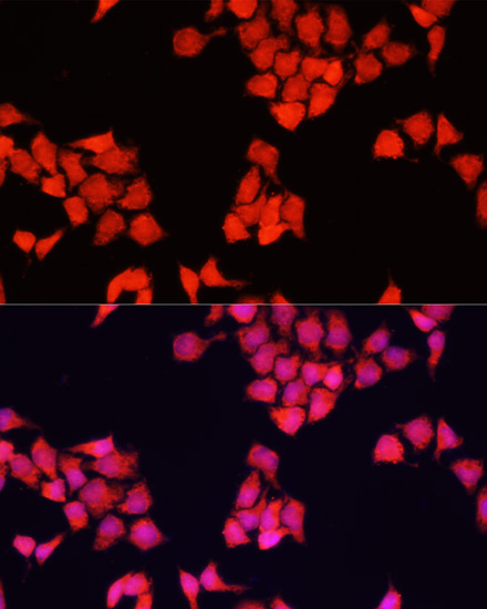 Anti-FXR1 Antibody