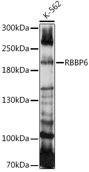 Anti-Retinoblastoma binding protein 6 Antibody