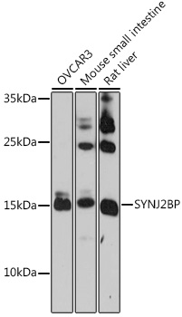 Anti-SYNJ2BP Antibody