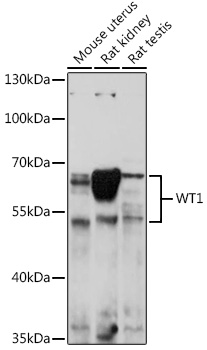 Anti-Wilms Tumor Protein Antibody