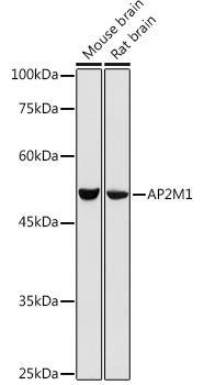 Anti-AP2M1 Antibody