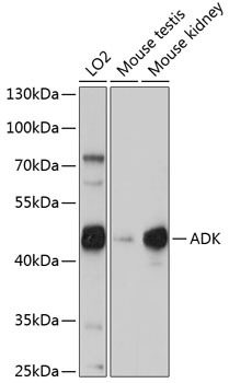 Anti-ADK Antibody