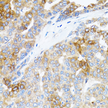 Anti-STAT3 Antibody