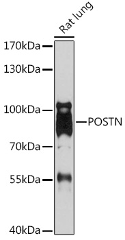 Anti-Periostin Antibody