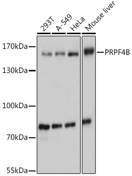 Anti-PRPF4B Antibody