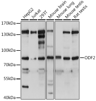 Anti-Cenexin1 / ODF2 Antibody