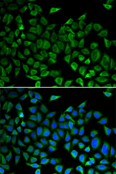 Anti-CDC45L Antibody