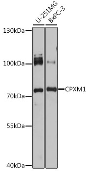 Anti-CPXM1 Antibody