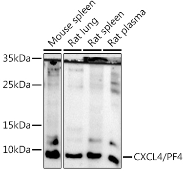 Anti-PF4 Antibody