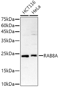 Anti-RAB8A Antibody
