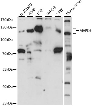 Anti-MAPK6 / ERK3 Antibody