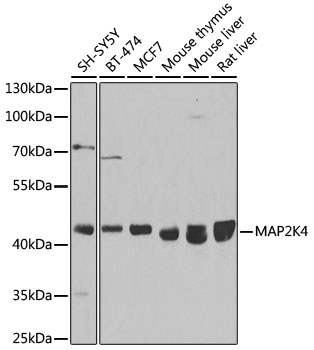 Anti-MEK4 / MKK4 Antibody