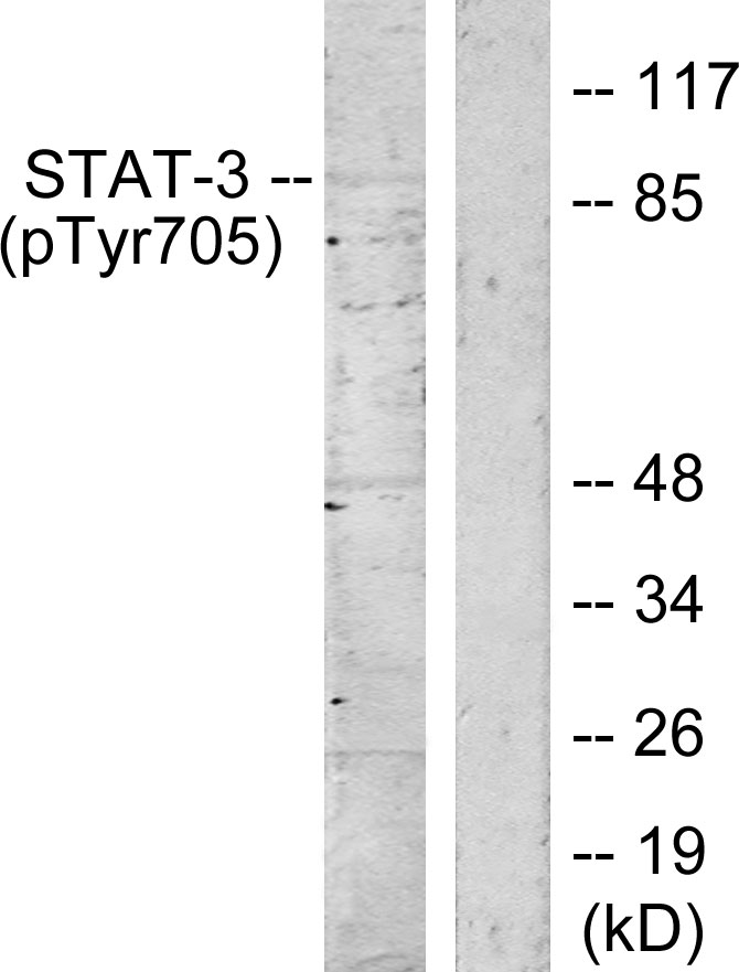 Anti-STAT3 (phospho Tyr705) Antibody