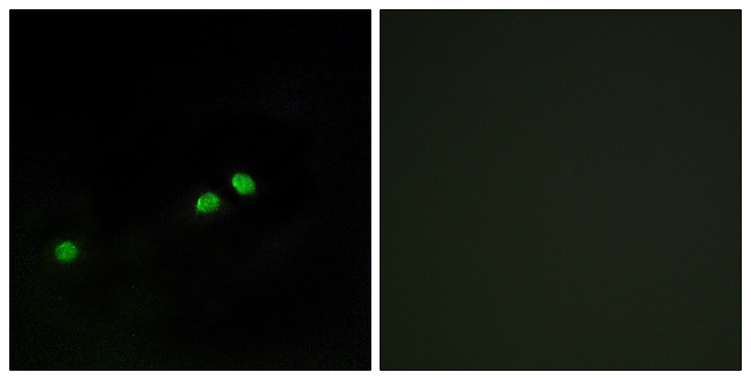 Anti-Centromeric Protein A (phospho Ser7) Antibody