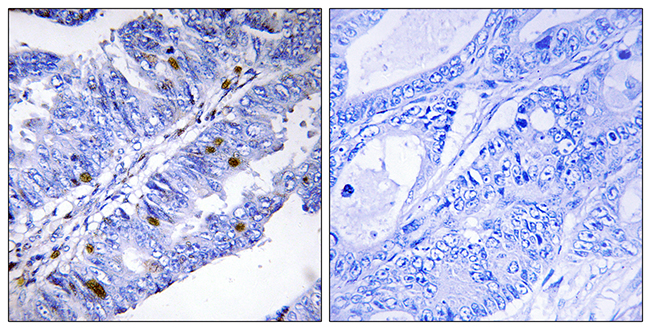 Anti-Nuclear Receptor NR4A1 (phospho Ser351) Antibody