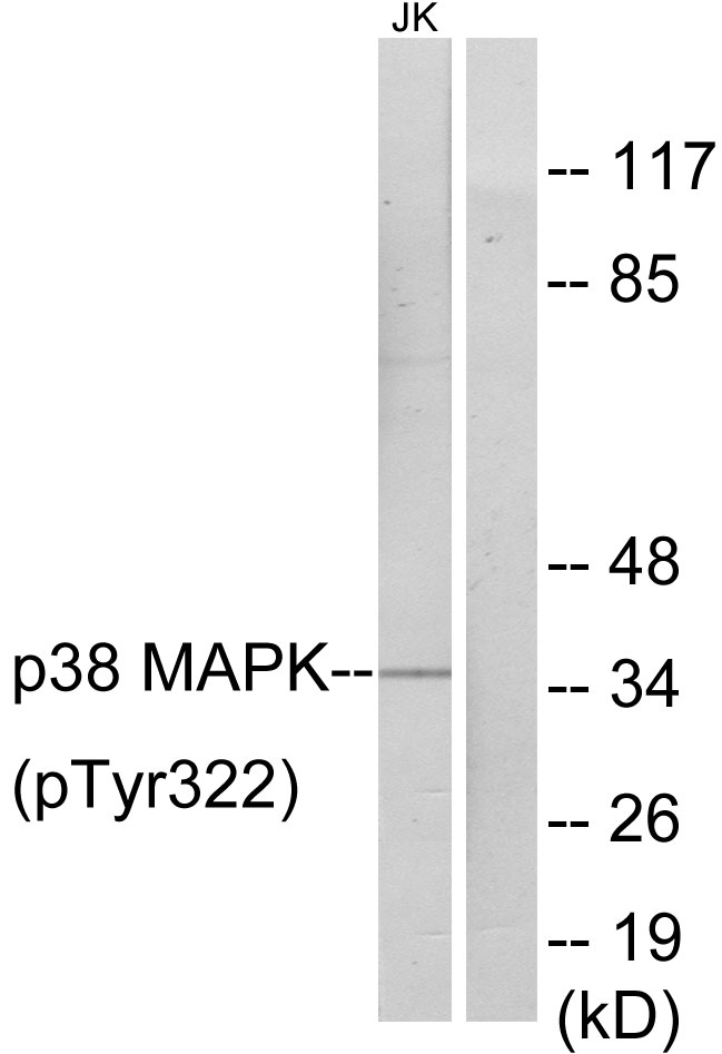 Anti-p38 MAPK (phospho Tyr322) Antibody