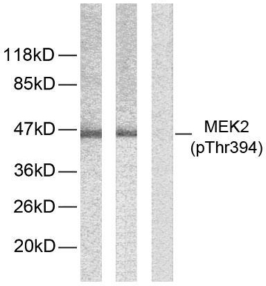 Anti-MEK2 (phospho Thr394) Antibody - Identical to Abcam (ab131095)