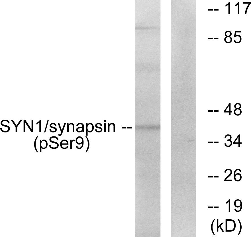 Anti-Synapsin (phospho Ser9) Antibody