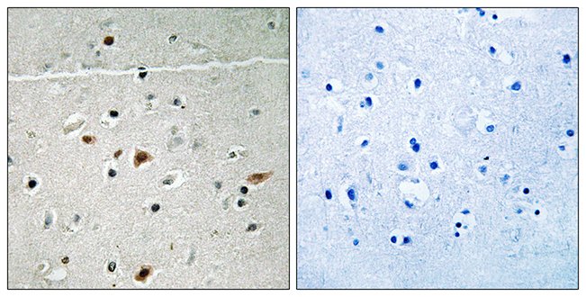 Anti-LIMK2 (phospho Ser283) Antibody