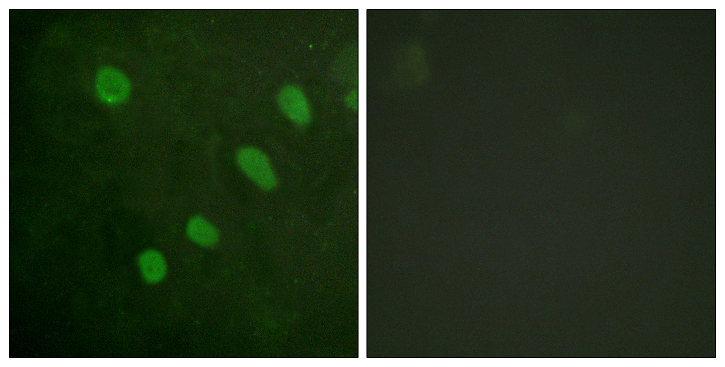 Anti-ATF2 (phospho Ser480) Antibody