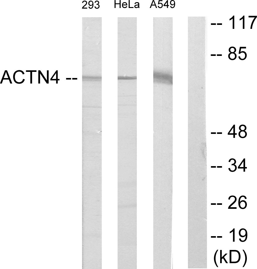 Anti-ACTN1 + ACTN2 + ACTN3 + ACTN4 Antibody