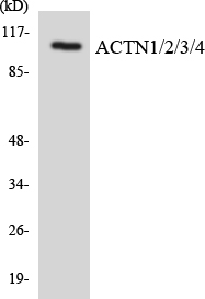 Anti-ACTN1 + ACTN2 + ACTN3 + ACTN4 Antibody