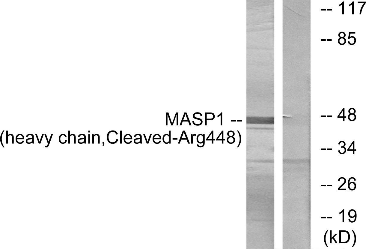 Anti-MASP1 (heavy chain,cleaved Arg448) Antibody