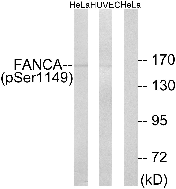 Anti-FANCA (phospho Ser1149) Antibody