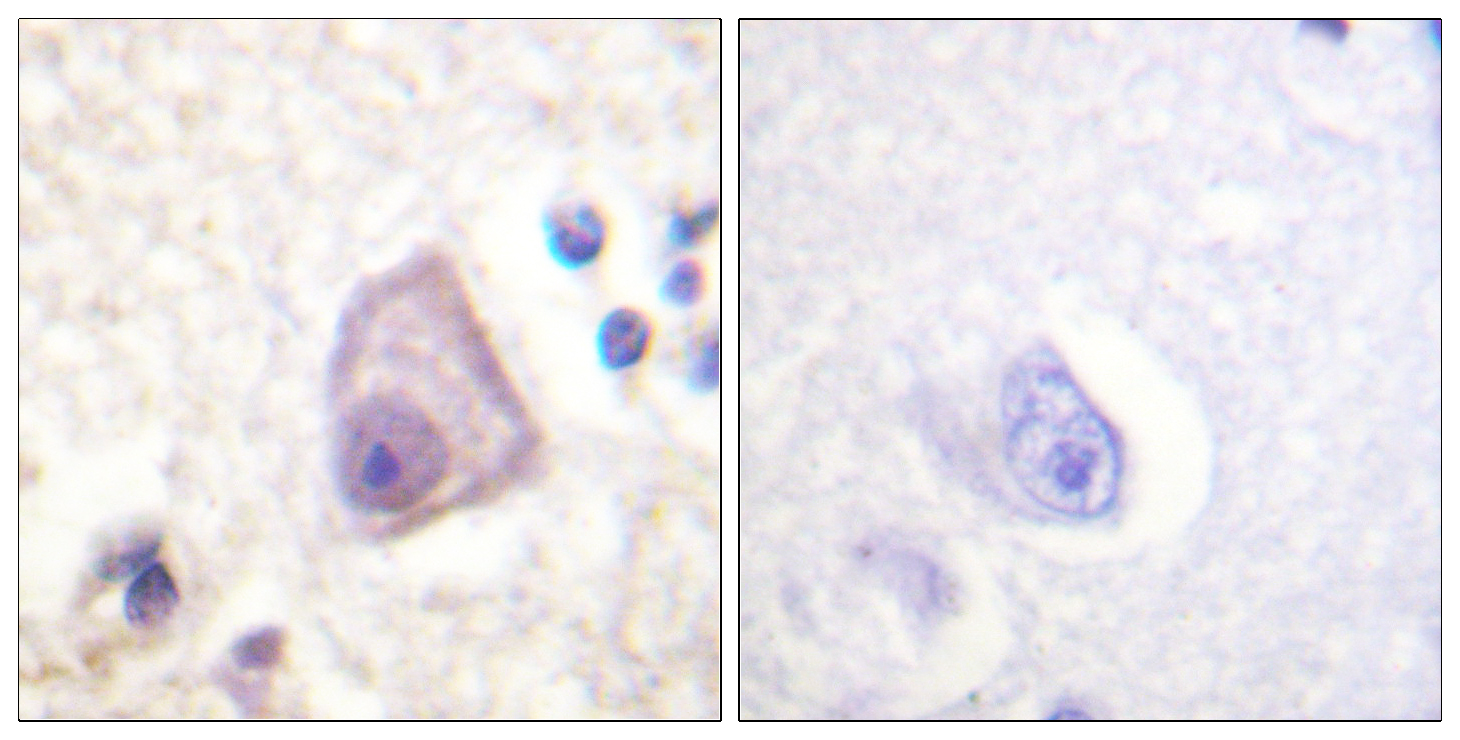 Anti-SEK1 (phospho Ser257) Antibody