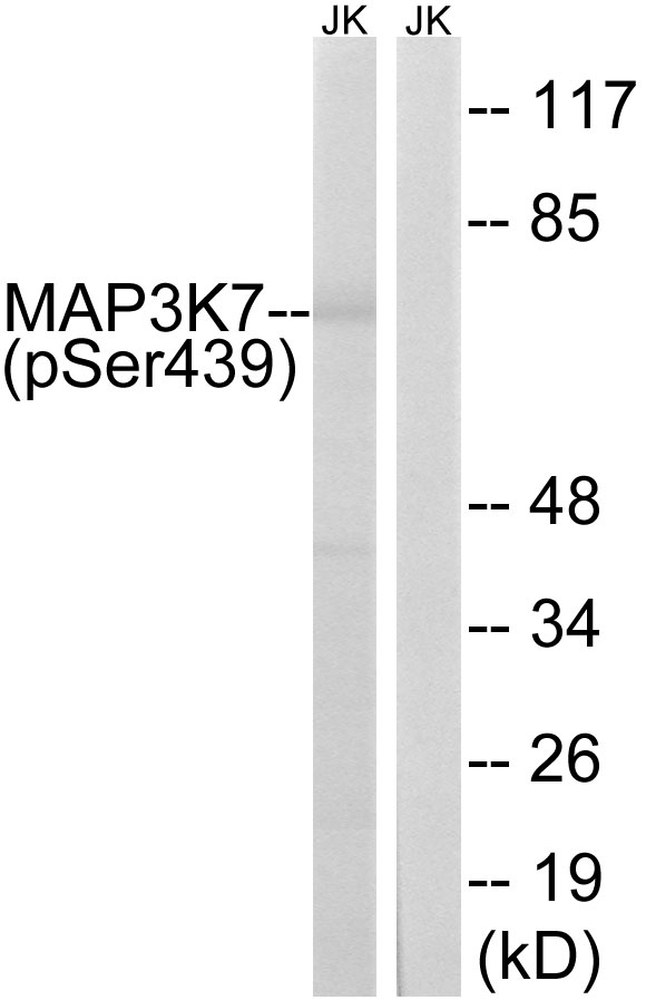 Anti-MAP3K7 (phospho Ser439) Antibody