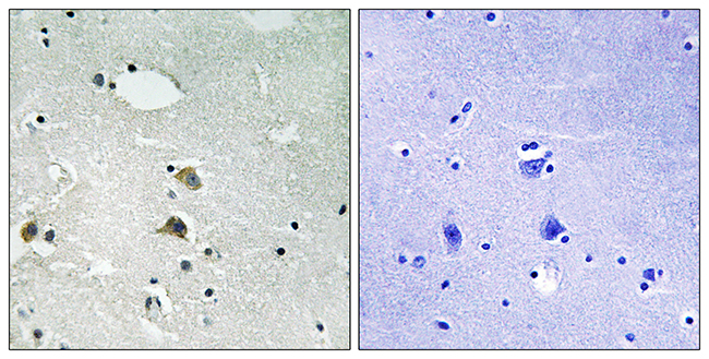 Anti-S6 Ribosomal Protein Antibody