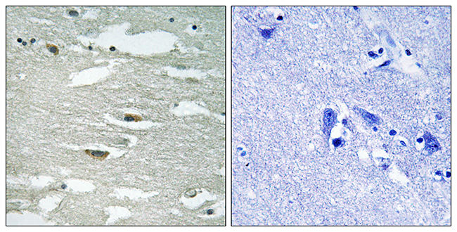 Anti-ILK (phospho Ser246) Antibody