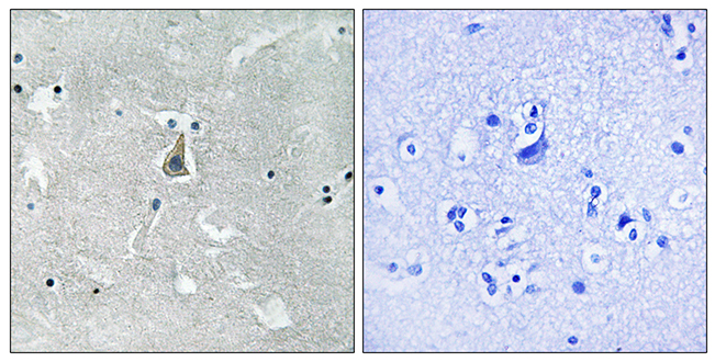 Anti-Bax (phospho Ser184) Antibody