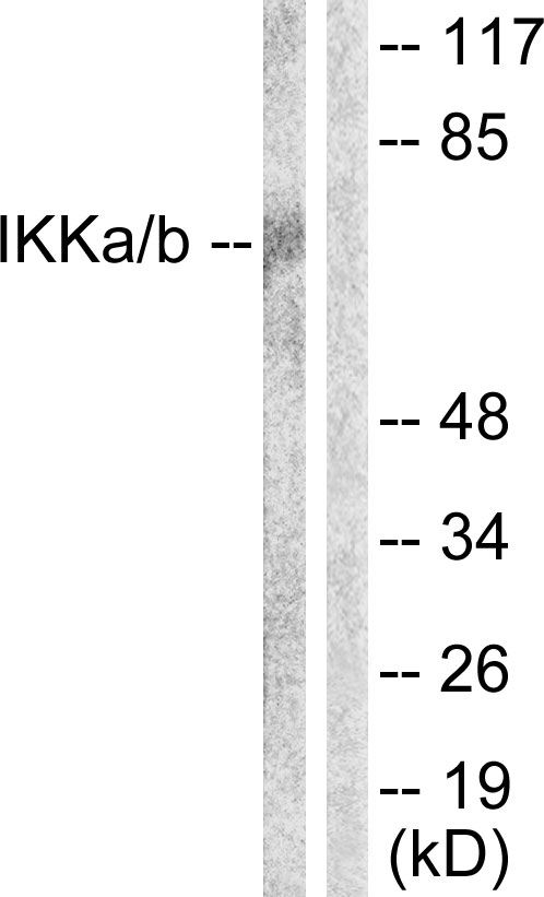 Anti-IKK alpha + beta Antibody