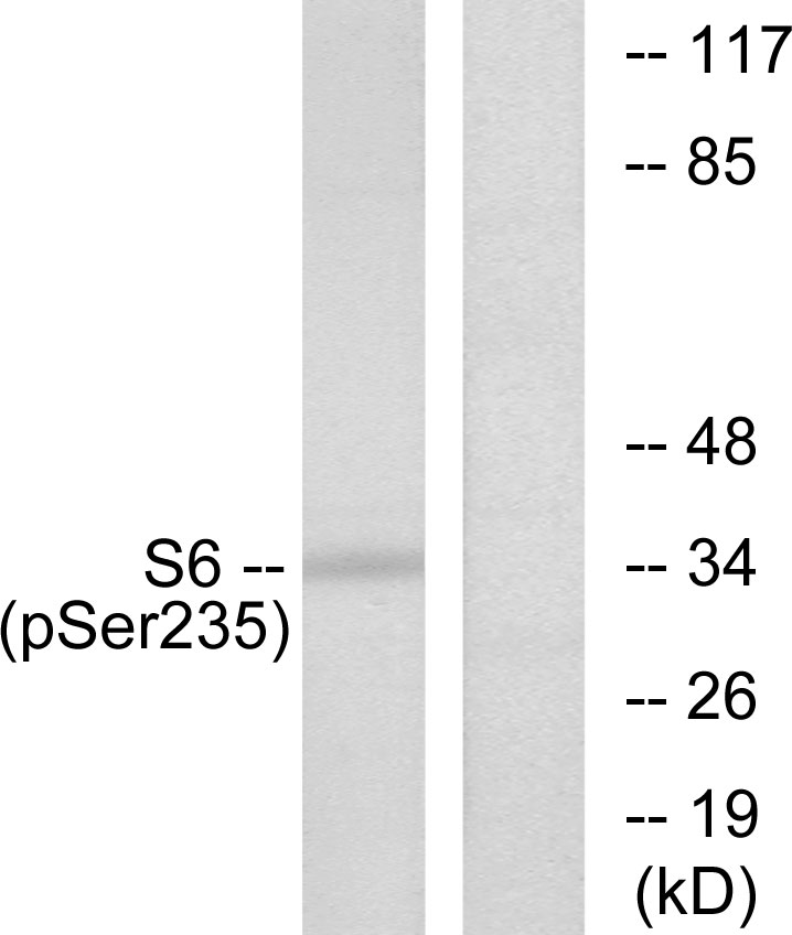 Anti-S6 Ribosomal Protein (phospho Ser235) Antibody