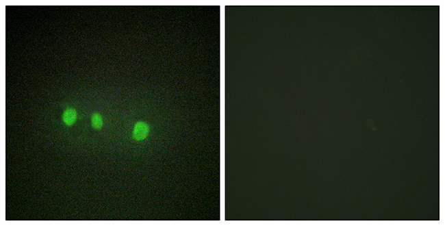 Anti-ZIC1 + ZIC2 + ZIC3 + ZIC4 + ZIC5 Antibody