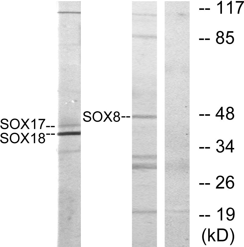 Anti-SOX8 + SOX9 + SOX17 + SOX18 Antibody