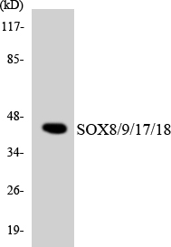 Anti-SOX8 + SOX9 + SOX17 + SOX18 Antibody