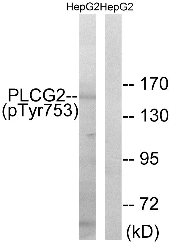Anti-PLCG2 (phospho Tyr753) Antibody