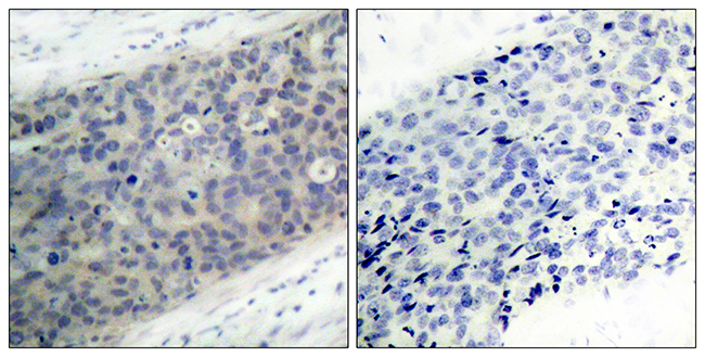 Anti-LIMK2 (phospho Thr505) Antibody